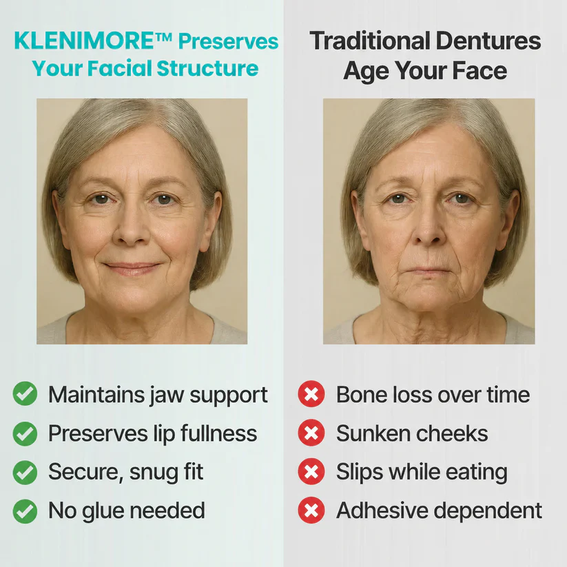 ⏰ Custom-Fit Dentures ENDS TODAY 70% OFF | Smile with Confidence|Buy 2, Get 1 Free
