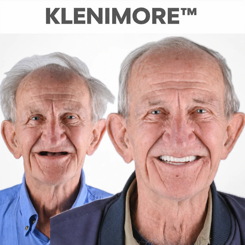 ⏰ Custom-Fit Dentures ENDS TODAY 70% OFF | Smile with Confidence|Buy 2, Get 1 Free
